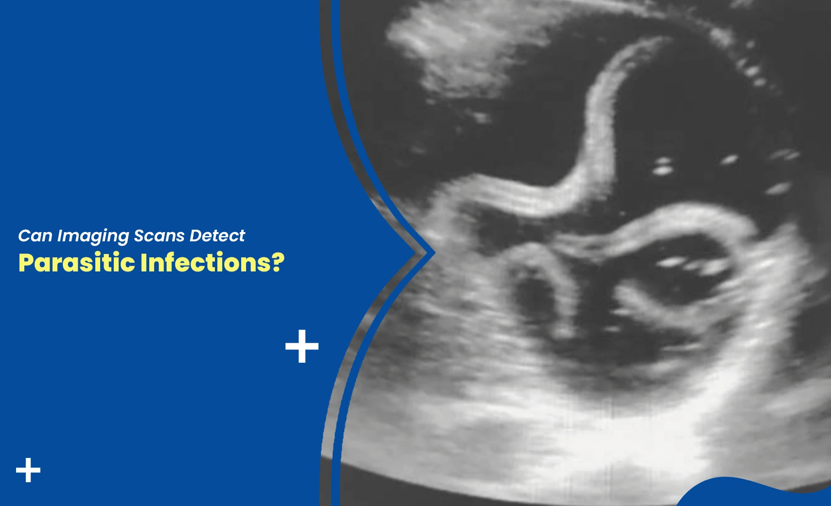 detecting parasitic infections