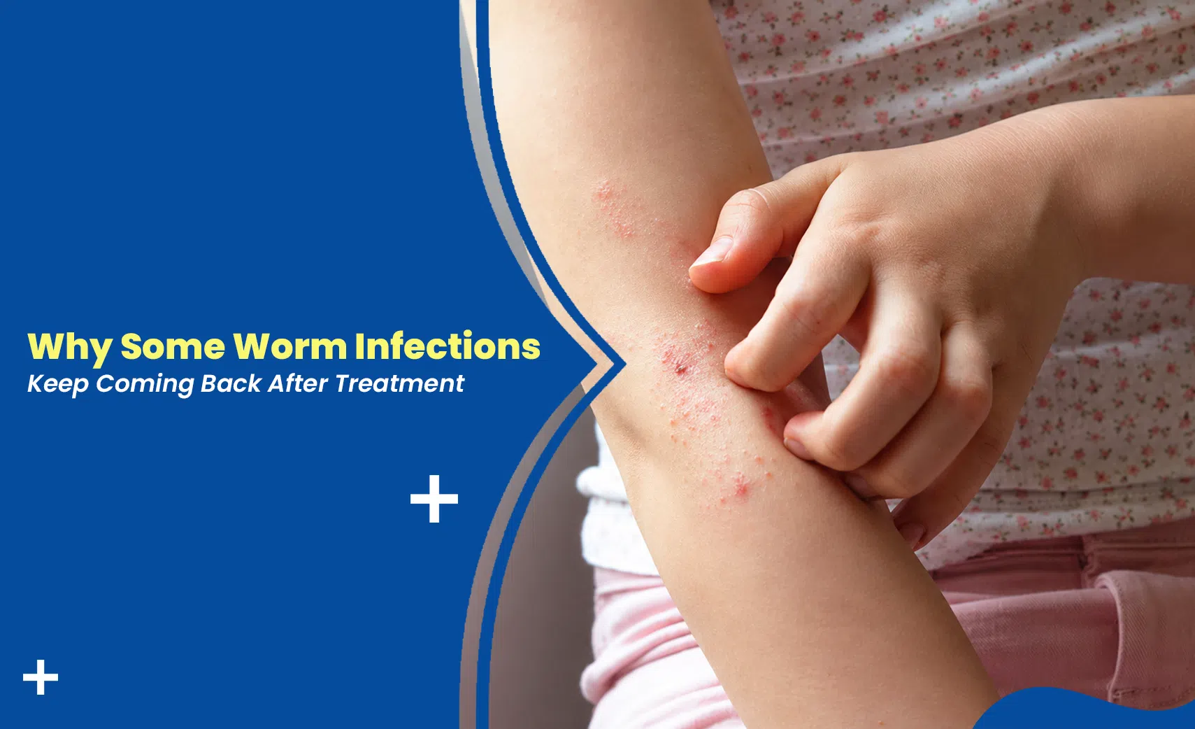 Worm infections keep coming back