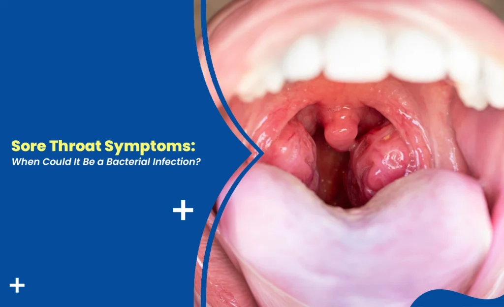 sore throats