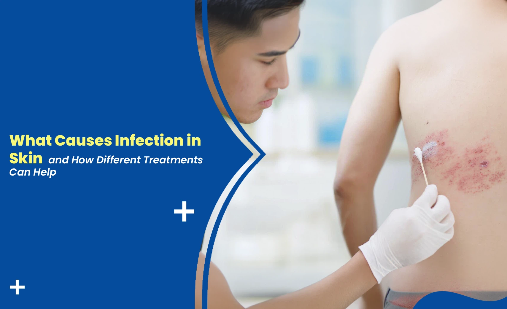 causes of infection in skin